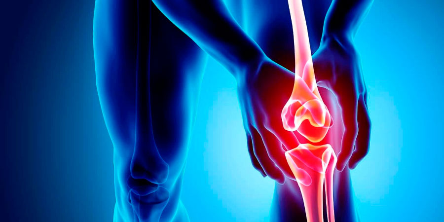 Osteoarthritis Osteoarthritis